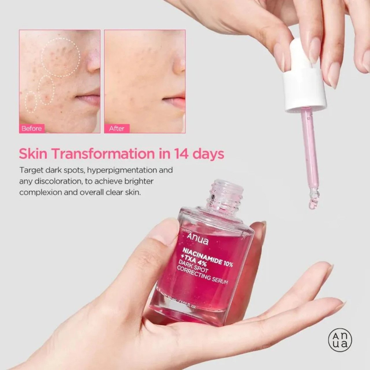 About 11 Anua_Niacinamide_10_TXA_4_Dark_Spot_Correcting_Serum_30_mL_KBeauty_Australia_-_improvement_in_14_days__74436