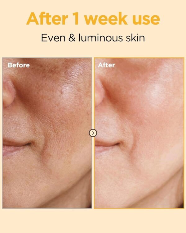 EASYDEW DW-EGF Peptide Melatoning Cream for Radiant Skin and Restores Sun Damaged Skin with Glutathione - Evens Skin Tone, Moisture Glow Skin, 3.6 oz. - Image 4