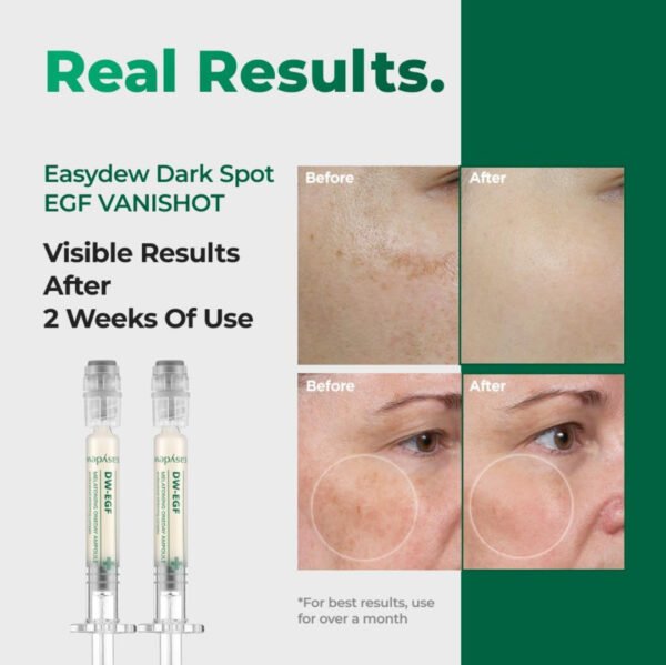 Easydew DW-EGF Melatoning One-Day Daily Clearing Ampoule Serum 0.3FL.OZ x 7EA - Image 7