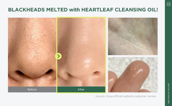 Anua Double Cleansing Duo SET for Facial Cleansing : Heartleaf Pore Control Cleansing Oil & Heartleaf Succinic Moisture Cleansing Foam for Double Cleansing, Blackhead Remover, Korean Skincare - Image 4