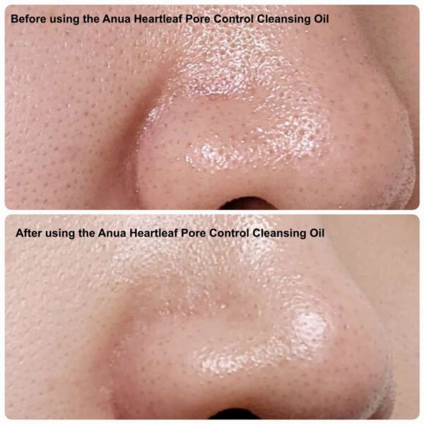 Anua Double Cleansing Duo SET for Facial Cleansing : Heartleaf Pore Control Cleansing Oil & Heartleaf Succinic Moisture Cleansing Foam for Double Cleansing, Blackhead Remover, Korean Skincare - Image 2