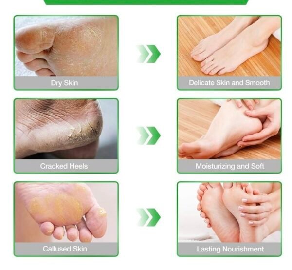 The Face Shop Smile Foot Peeling Jellly Mask For Unisex 40ml - Image 5