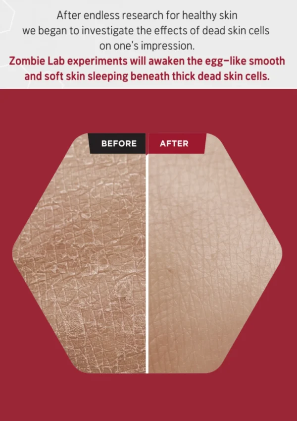 SKIN1004 Bloody Peel 1.01 fl.oz, 30ml AHA 17% Peeling Solution, Pulls off Dramatic Exfoliation Effect with Special Home-care - Image 6
