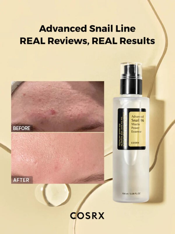 Advanced Snail Mucin 96% Power Repairing Essence, Snail 96% Mucin Essence - Anti-Aging Serum, with Snail Secretion Filtrate for Dull and Damaged Skin - Image 2