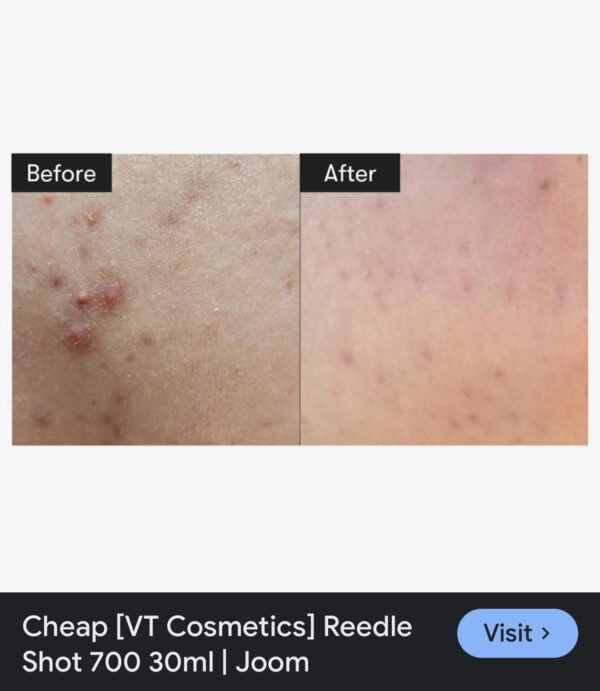 VT COSMETICS CICA Reedle Shot 700, Spicule Microneedling Serum for Pore Care&Exfoliation, Exosome&Centella Asiatica for Glass Skin, Acne&Blemish Care, Korean Liquid Skin Booster (1 Fl Oz / 30ml) - Image 3