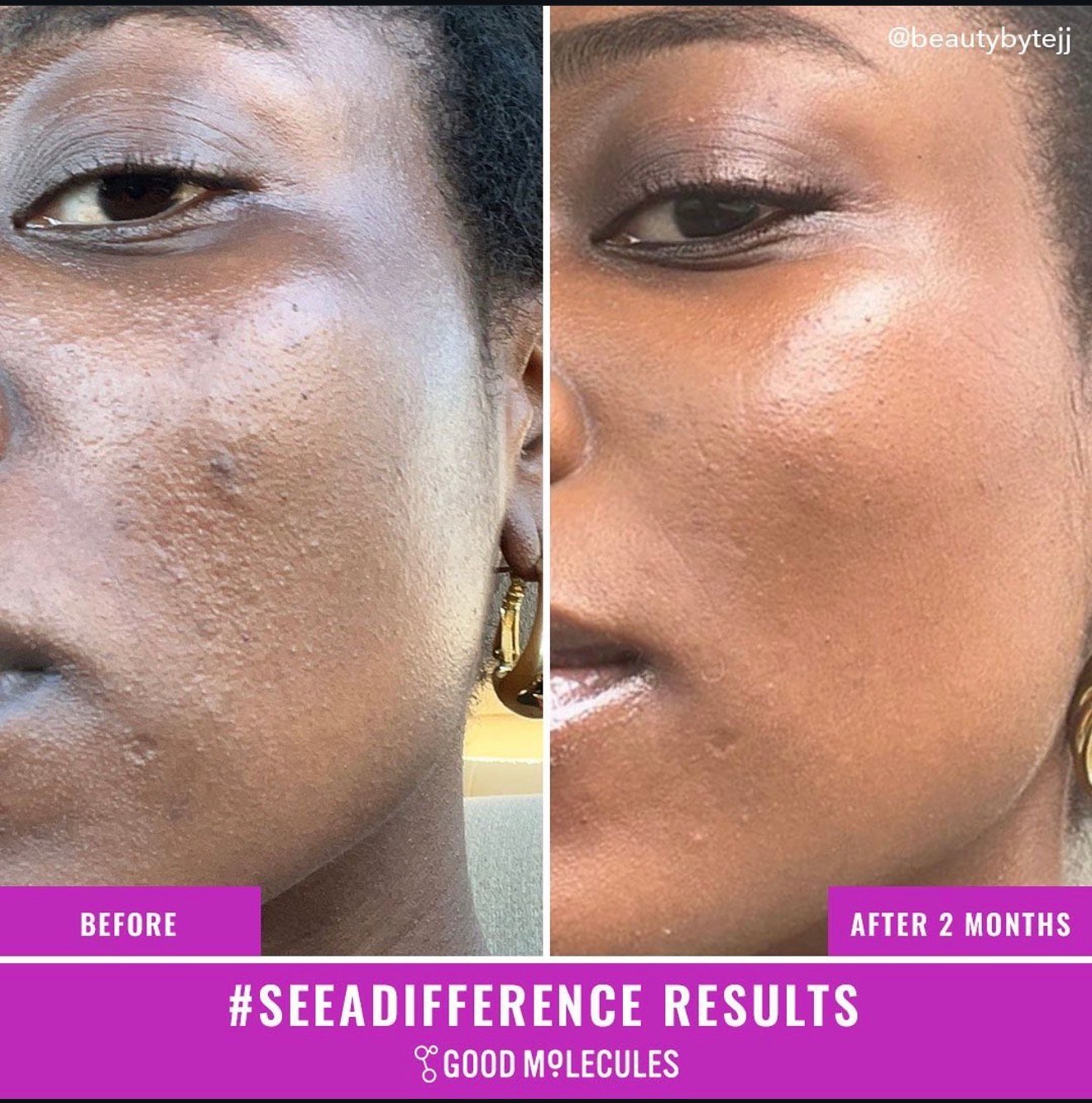 Good Molecules Discoloration Correcting Serum - Tranexamic Acid and Niacinamide Serum to Target Dark Spots and Hyperpigmentation - Skin Care for Face 75ml Big Bottle 5 Good Molecules Discoloration Correcting Serum - Tranexamic Acid and Niacinamide Serum to Target Dark Spots and Hyperpigmentation - Skin Care for Face 75ml Big Bottle - Image 5
