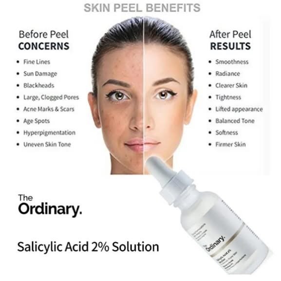 The Ordinary Salicylic Acid 2% Solution, Acne-Fighting Serum for Blemish-Prone Skin 2 The Ordinary Salicylic Acid 2% Solution, Acne-Fighting Serum for Blemish-Prone Skin - Image 2