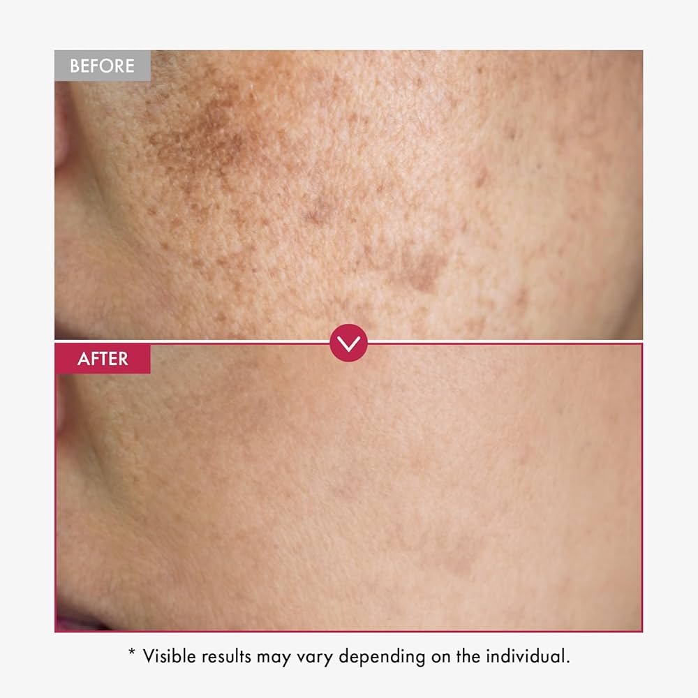 medicube TXA+Niacinamide Capsule Cream | Dual Radiance Moisturizer, Ideal for Use After Spot Care | For Uneven Skin Tone, Texture & Hydration | 99% Pure Tranexamic Acid | Korean Skincare | 1.94oz 7 medicube TXA+Niacinamide Capsule Cream | Dual Radiance Moisturizer, Ideal for Use After Spot Care | For Uneven Skin Tone, Texture & Hydration | 99% Pure Tranexamic Acid | Korean Skincare | 1.94oz - Image 7
