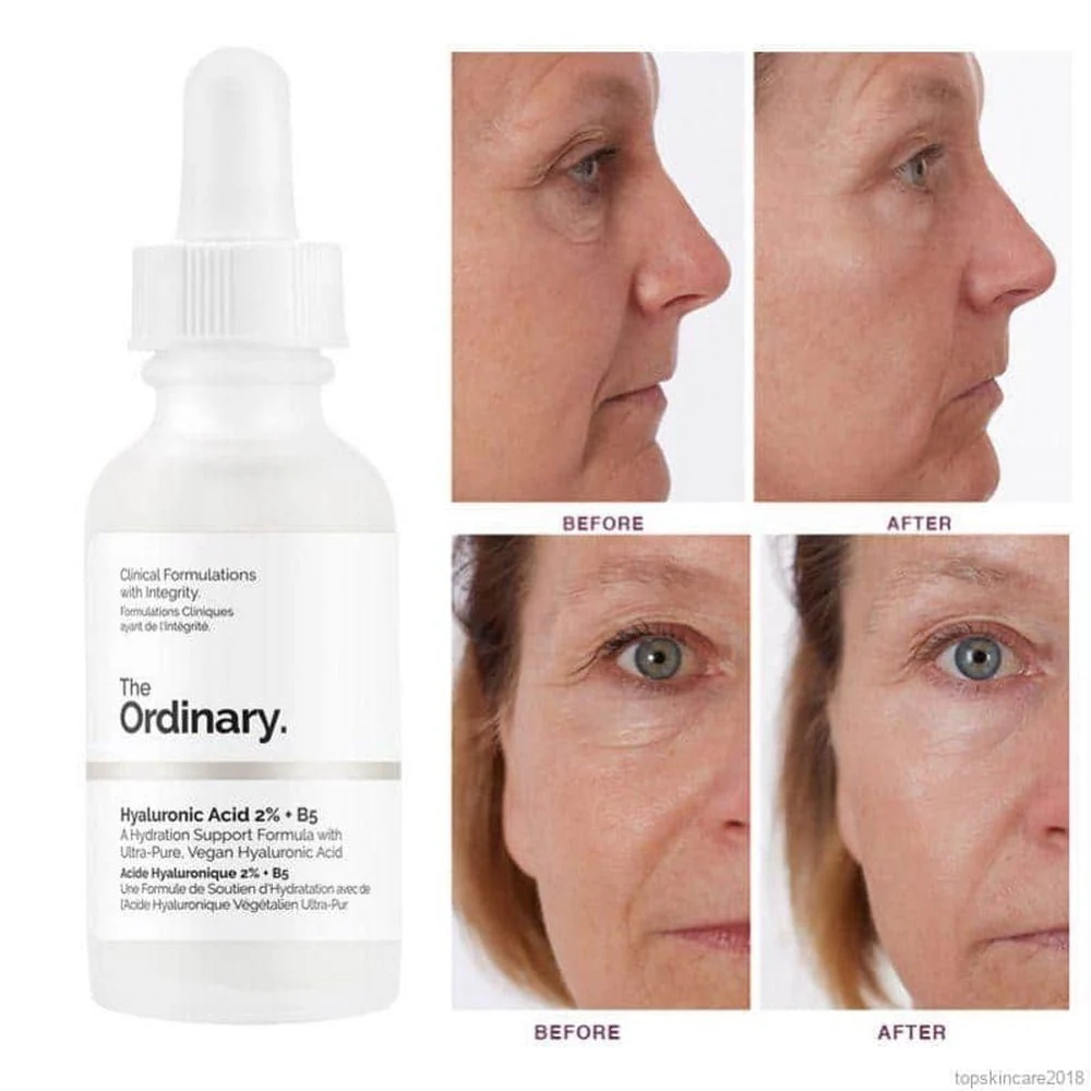 The Ordinary Hyaluronic Acid 2% + B5 (with Ceramides), Multi-Depth Hydration Serum for Plumper, Smoother Skin 3 The Ordinary Hyaluronic Acid 2% + B5 (with Ceramides), Multi-Depth Hydration Serum for Plumper, Smoother Skin - Image 3