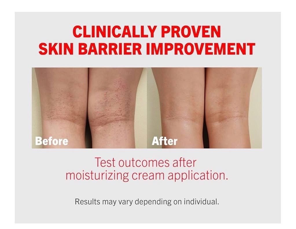 MLE Skin Barrier Technology + Ceramide Intensive Moisturizing Cream | Hydrating Face & Body Moisturizer for Dry & Sensitive Skin | Panthenol Barrier Repair Lotion | ATOPALM | 3.4 fl oz (100ml) 4 MLE Skin Barrier Technology + Ceramide Intensive Moisturizing Cream | Hydrating Face & Body Moisturizer for Dry & Sensitive Skin | Panthenol Barrier Repair Lotion | ATOPALM | 3.4 fl oz (100ml) - Image 4