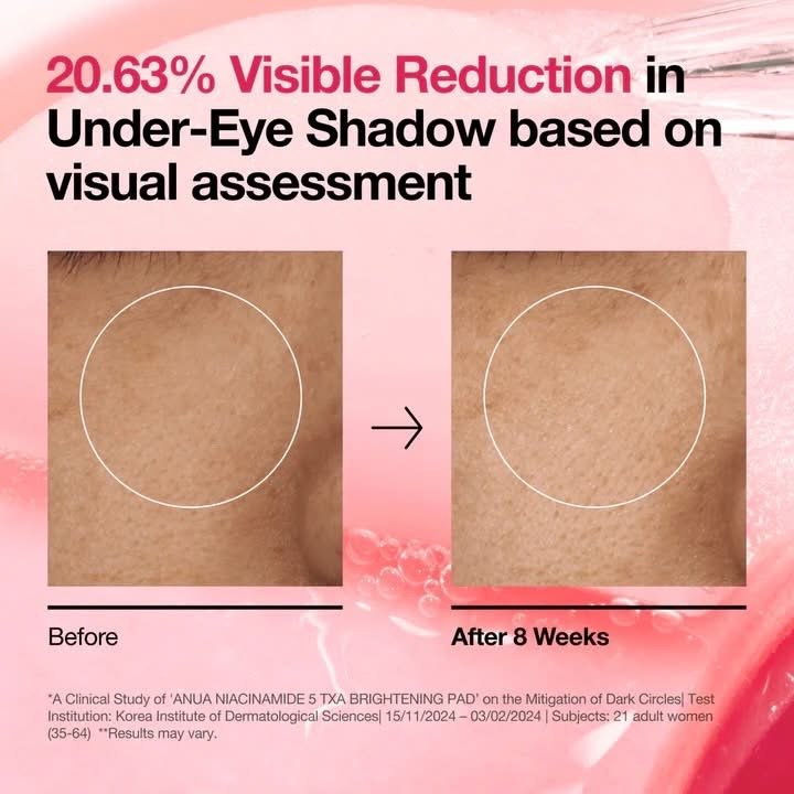 Anua Niacinamide 5 TXA Toner Pads – Hydrating Facial Pad for Daily Care, Under-eye with Tranexamic acid, Korean Skin Care (210ml, 60 Pads) 4 Anua Niacinamide 5 TXA Toner Pads – Hydrating Facial Pad for Daily Care, Under-eye with Tranexamic acid, Korean Skin Care (210ml, 60 Pads) - Image 4