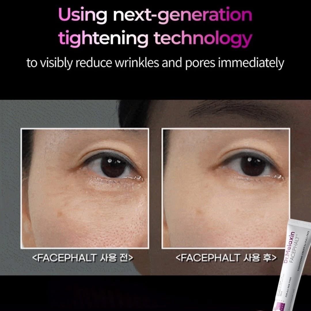 Dr. Melaxin Face Phalt Tightening Cream, 1.7 fl oz (50 ml), Pores, Lifting, Wrinkles, Hali, Sebum, Collagen, Volume, Calamine, Korean Skin Care, Korean Cosmetics 2 Dr. Melaxin Face Phalt Tightening Cream, 1.7 fl oz (50 ml), Pores, Lifting, Wrinkles, Hali, Sebum, Collagen, Volume, Calamine, Korean Skin Care, Korean Cosmetics - Image 2